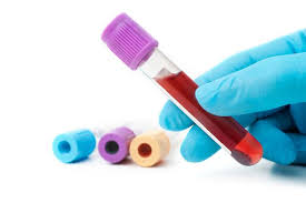 DUI-Blood-Test