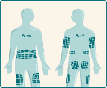 Insulin Injection Rotation Sites Chart